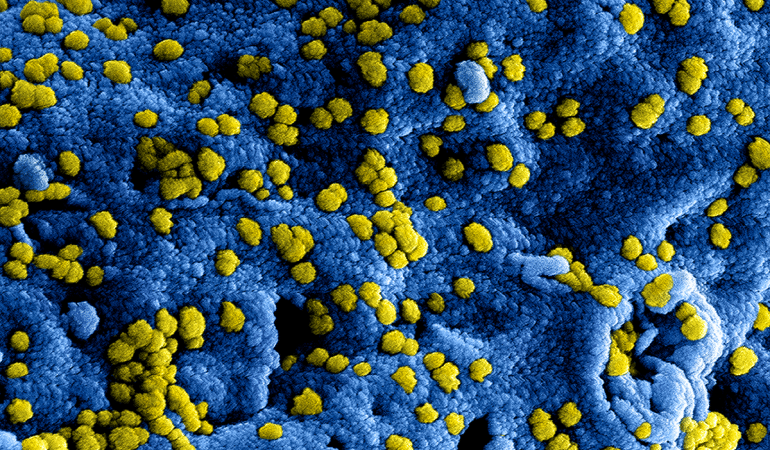 Foto van het Coronavirus